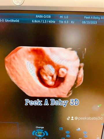 F95E71CC-2F89-491D-915E-33B4F879D322_4_5005_c