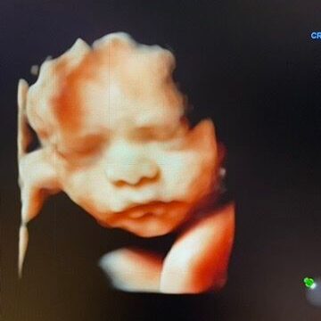 A8903191-0CA3-4603-9636-0261D85E01A9_4_5005_c